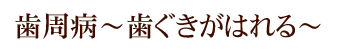 歯周病～歯ぐきがはれる～