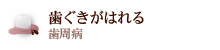 歯ぐきがはれる